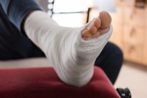 Person's ankle in a cast following an ankle injury