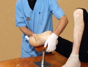 A doctor looking at a leg that was amputated halfway