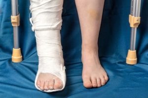 Fractured heel at work injury personal injury claims payouts for a fractured heel