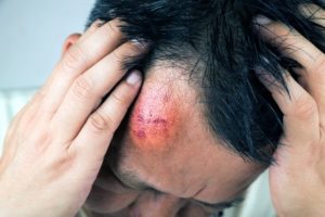 assault claim