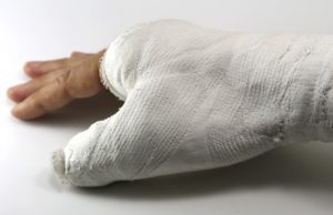 Broken thumb compensation personal injury claims payouts for a broken thumb
