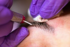 Eyebrow tint compensation personal injury claims payouts for a botched eyebrow tint.
