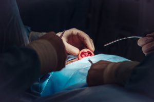 Surgeons perform cosmetic surgery on patient