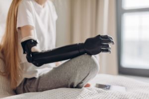 A girl who has lost her arm sitting on a bed with a new prosthetic arm