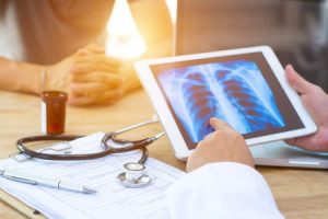 Doctor and patient sitting at a desk examining a chest x-ray result