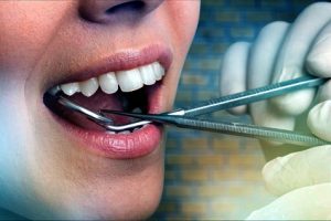 dentist data breach dentist breached my personal data