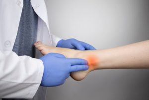 Doctor pointing to an Achilles tendon injury