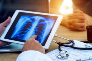 How to make pneumoconiosis claims for compensation guide