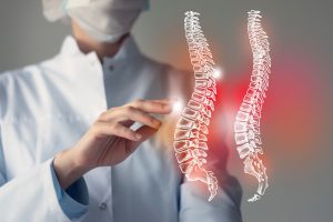 Doctor looking at images of spine injuries