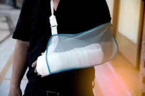 Man with a broken left arm wearing a sling