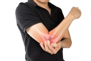A guide to elbow injury compensation amounts in the UK