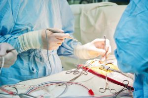 Surgeons around an operation table holding medical equipment and tools.