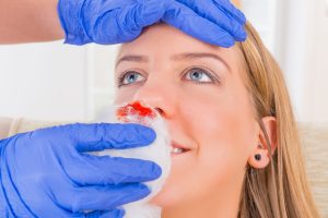 A nurse helps a woman with a nose bleed.