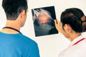 Doctors assess an x-ray of a head injury.