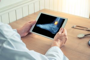 MEDICAL PROFESSIONAL LOOKING AT ANKLE FRACTURE ON A TABLET
