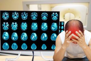 Doctor facing medical negligence claims for incorrect brain diagnosis